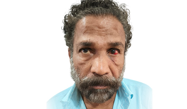 ഉടമയെയും ഡ്രൈവറെയും മര്‍ദിച്ച് വാഹനം തട്ടികൊണ്ടുപോയ സംഭവത്തില്‍ സഹായി പിടിയില്‍