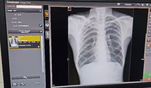 വയനാട് ഗവ മെഡിക്കല്‍ കോളെജിലെ എക്‌സ്-റേ സംവിധാനം പ്രവര്‍ത്തന സജ്ജം