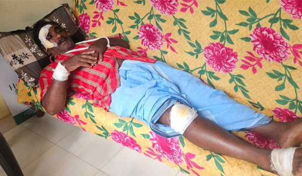 കാട്ടുപന്നി കുറുകെ ചാടി; സ്‌കൂട്ടര്‍ യാത്രികന്  പരിക്കേറ്റു.